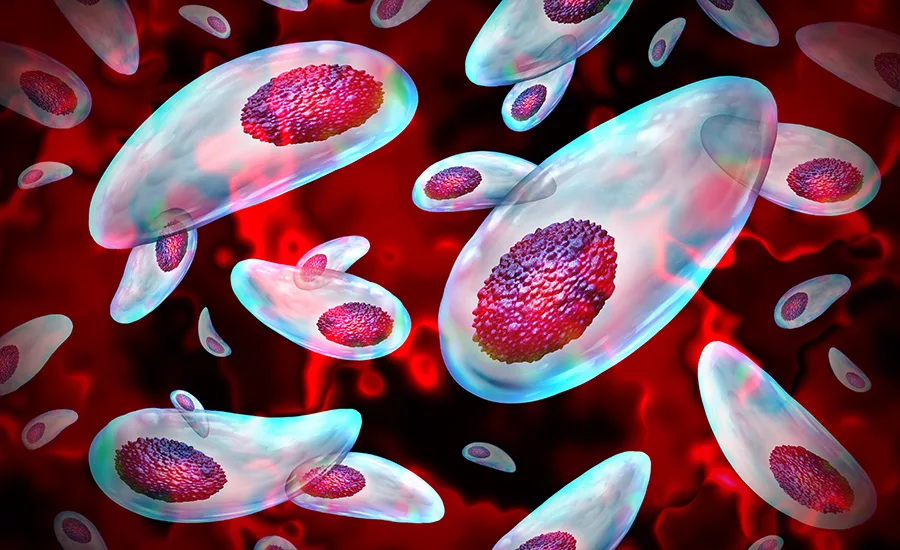 Toxoplasma gondii infection