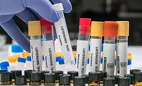 various laboratory test tubes for detecting the presence of Listeria bacteria. various laboratory test tubes for detecting the presence of Listeria bacteria.
