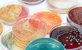 bacterial colonies growing on a culture medium, likely in a Petri dish.