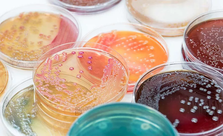 bacterial colonies growing on a culture medium, likely in a Petri dish. bacterial colonies growing on a culture medium, likely in a Petri dish.