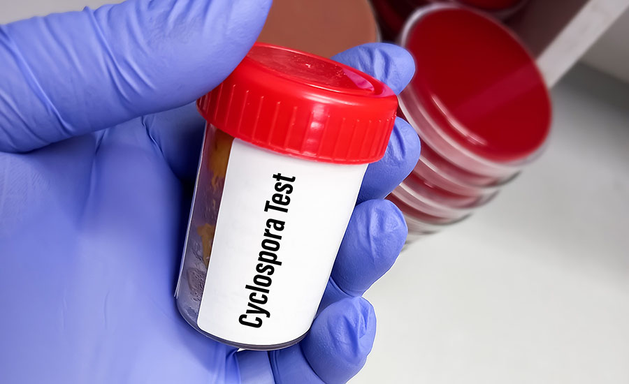 cyclospora test