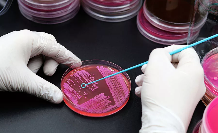 a petri dish filled with agar gel