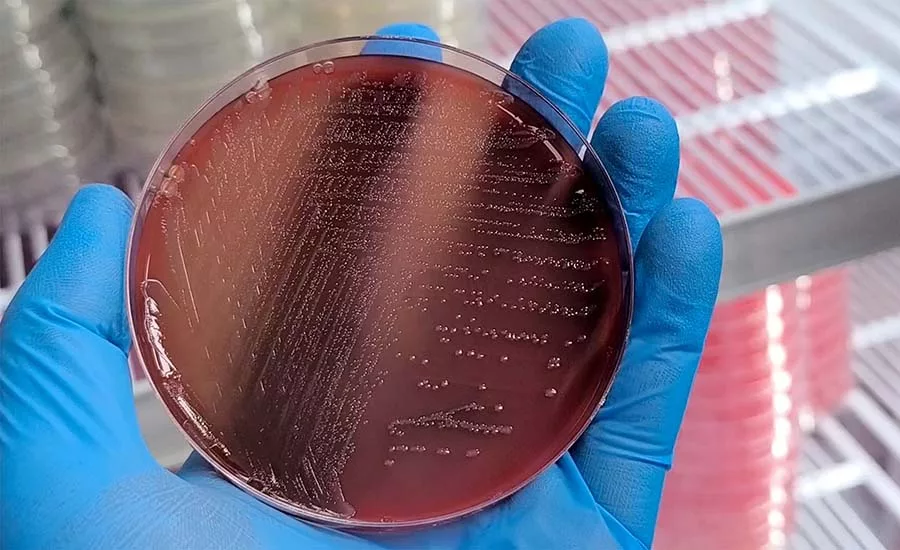 a Petri dish containing a microbial culture medium