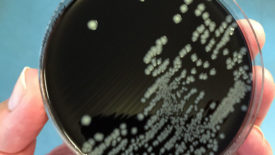 Campylobacter in petri dish