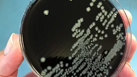 Campylobacter in petri dish