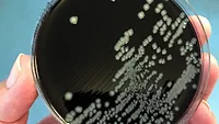 Campylobacter in petri dish Campylobacter in petri dish
