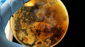 brown bacterial cultures in petri dish