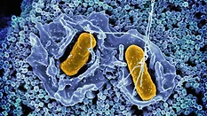 Salmonella invading a human cell