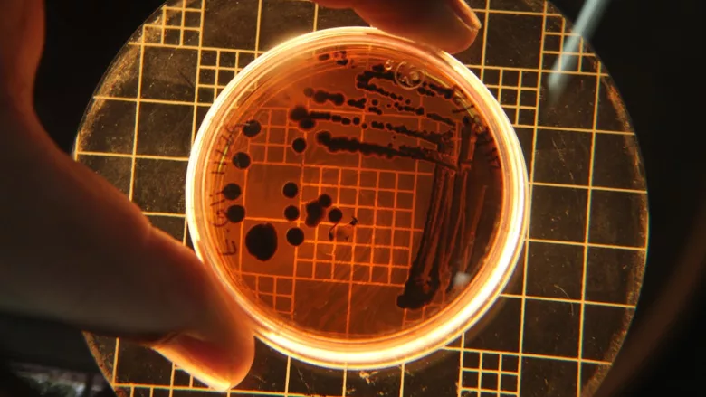 bacterial colonies shown under a light