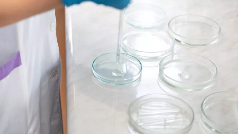 researcher dropping liquid in petri dishes