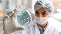 microbiologist examining petri dish with microbial colonies