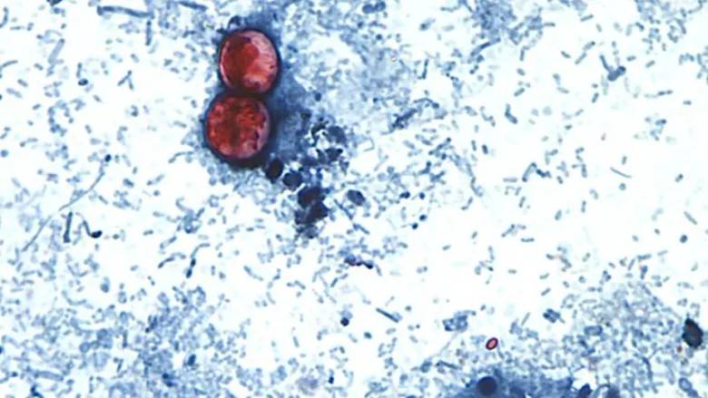 Cyclospora cayetanensis oocysts