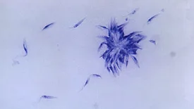 Trypanosoma cruzi under microscope