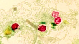 cryptosporidium oocysts