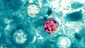 Cyclospora cayetanensis oocyst