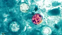 cyclospora oocyst_CDC DPDx - Melanie Moser via CDC PHIL.png Cyclospora cayetanensis oocyst