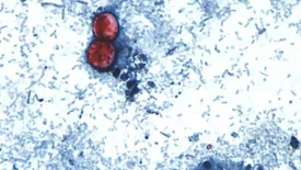 Cyclospora cayetanensis oocysts