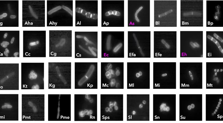 ancera clostridium TVB assays