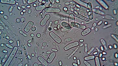 rod shaped bacteria and other microbes under microscope view
