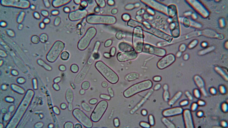 rod shaped bacteria and other microbes under microscope view