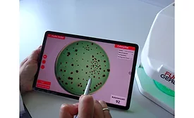 ColonyStar Colony Counter with Detachable Tablet