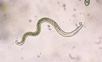 Trichinella Trichinella