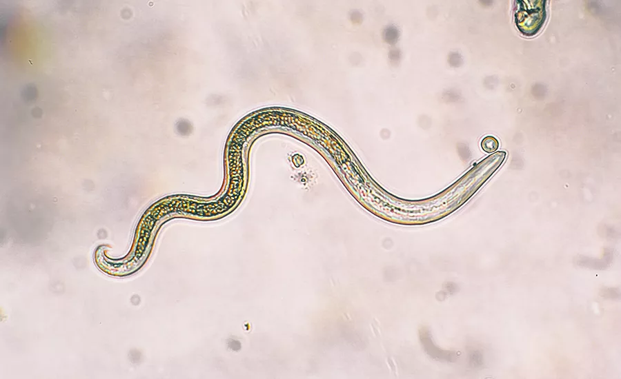 Trichinella
